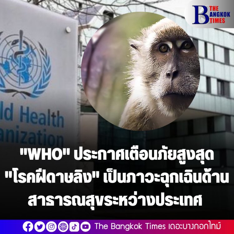 ด่วน!!  "WHO" ประกาศเตือนภัยสูงสุด "โรคฝีดาษลิง" เป็นภาวะฉุกเฉินด้านสาธารณสุขระหว่างประเทศ (PHEIC) 