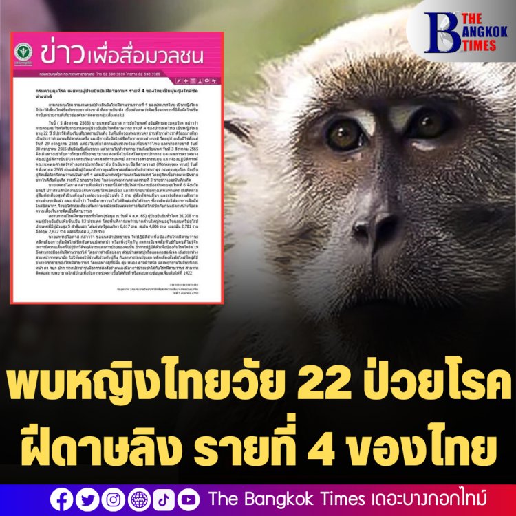 พบหญิงไทยวัย 22 ป่วยโรคฝีดาษลิง รายที่ 4 ของไทย มีประวัติเสี่ยงไปเที่ยวสถานบันเทิง  ใกล้ชิดต่างชาติ