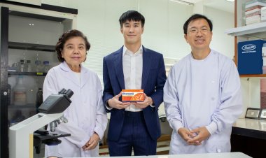 คณะวิจัยทีมแพทย์จุฬาค้นพบ L34 – โพรไบโอติกสายพันธุ์ใหม่ใช้รักษาสุขภาพลำไส้คนไทย