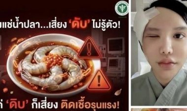อุทาหรณ์สายดิบแซ่บ! กิน "กุ้งแช่น้ำปลา"พยาธิไชลามขึ้นตา หวิดตาบอด