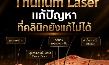 Fractional Laser Thulium นวัตกรรมเลเซอร์ช่วยรีเซ็ตผิวใหม่